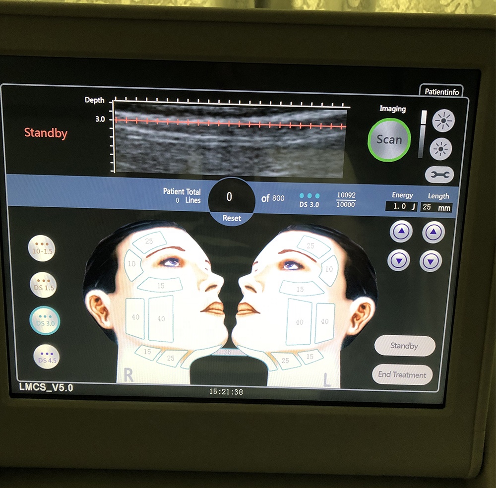 Smas hifu with 3 or 5 cartridges 10000 shot/ high intensity focused ultrasound hifu for face and body