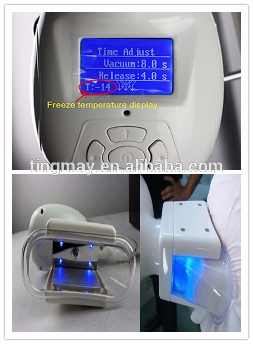OEM&ODM supplier cavitation system 2 handle portable cryolipolysis fat freeze for slimming