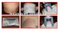 Lipo Cryo/Cryo Lipo/Cryo Lipolysis Fat Dissove Slimming Machine