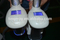cryolipolyse criolipolisis with double cryo handle fat freezing slimming machine