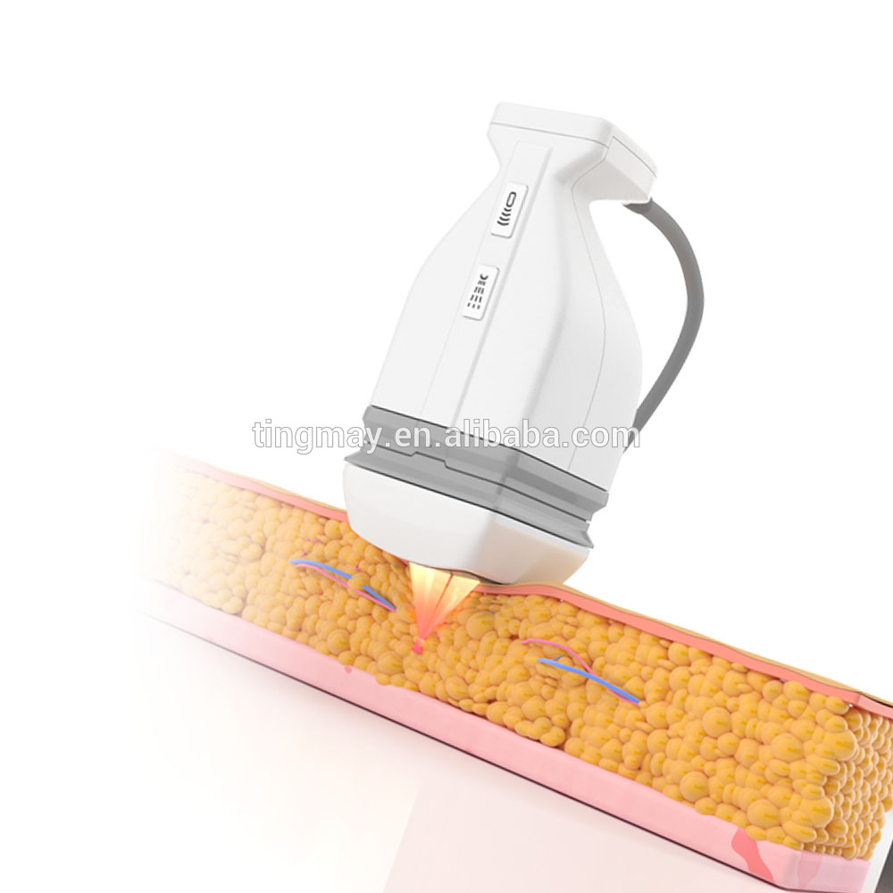 LIPO HIFU machine HIFU body slimming